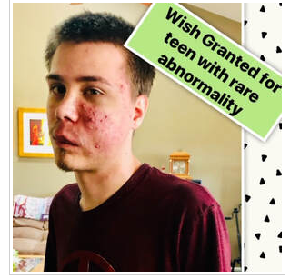 A WISH FOR FAMILY IS GRANTED FOR TEEN WITH RARE BLOOD VESSEL ABNORMALITY.